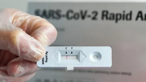 Covid-19 : les grandes surfaces autorisées à vendre des autotests